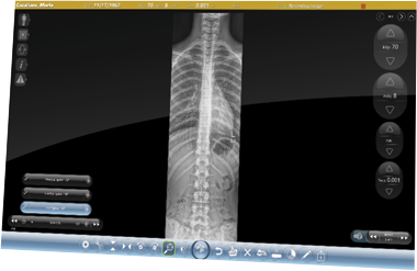 Completed Spinal Stitching Study